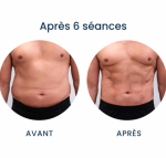 Ultra sculpt Lasers Machines