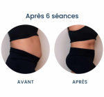 Ultra sculpt Lasers Machines